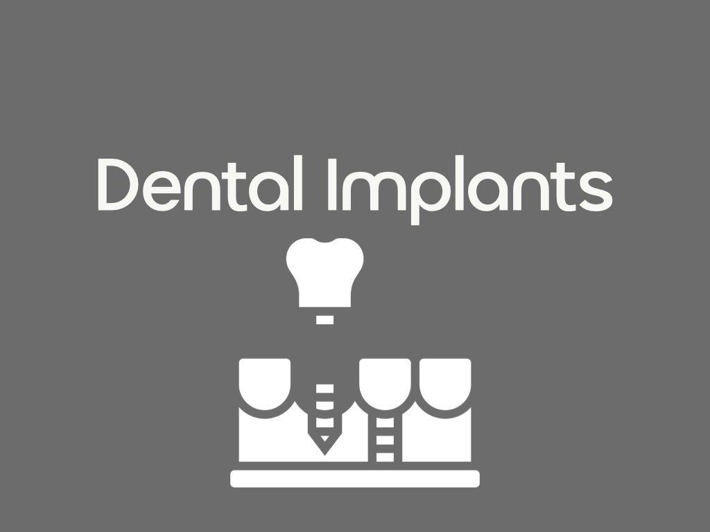 Dental Implants Alternative Treatment In Dentist in Mexico